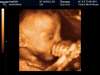babygirl2.jpg