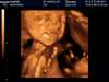 babygirl3.jpg